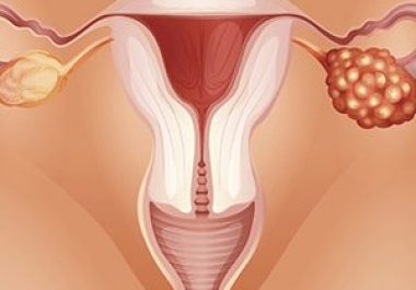 Ovarian Cancer: Unique Challenges and Opportunities for Progress