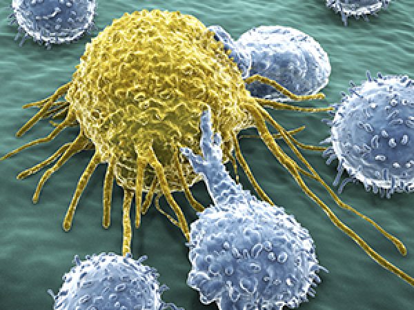 Advances in Immunotherapy: Tackling CAR T-cell Therapy Resistance