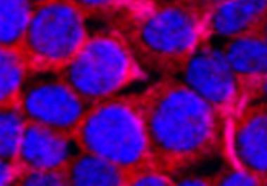 Nanotherapeutic Approved for Advanced Pancreatic Cancer