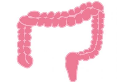 A New Colorectal Cancer Screening Test