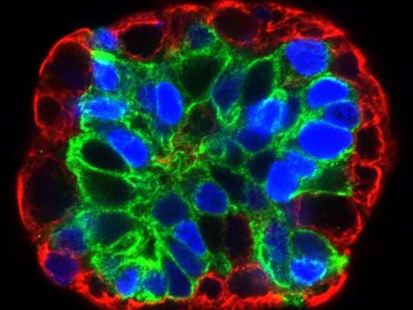 NCI Collection Offers a Look at “Cancer Close Up”