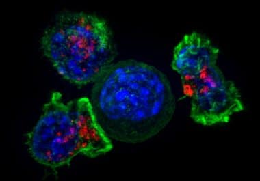 Immunotherapeutic Use Expanded to Bladder Cancer