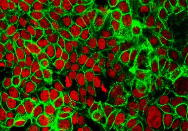 Expanding the Use of an Immunotherapeutic to Colorectal Cancer