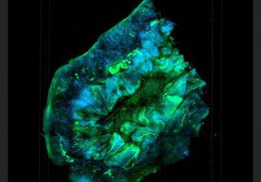 Looking Inside the Tumor Microenvironment