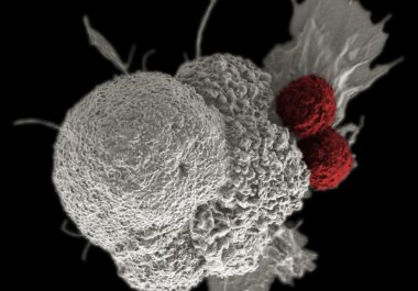 How Does Lung Cancer Evade the Immune System?