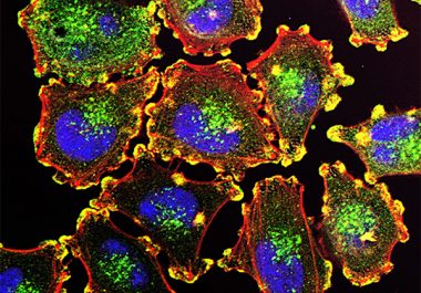 A New Targeted Therapy Combination for Melanoma