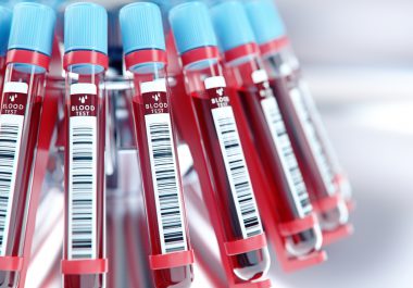 How Liquid Biopsies Can Complement Tissue Biopsies