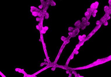 Advances in Breast Cancer Research