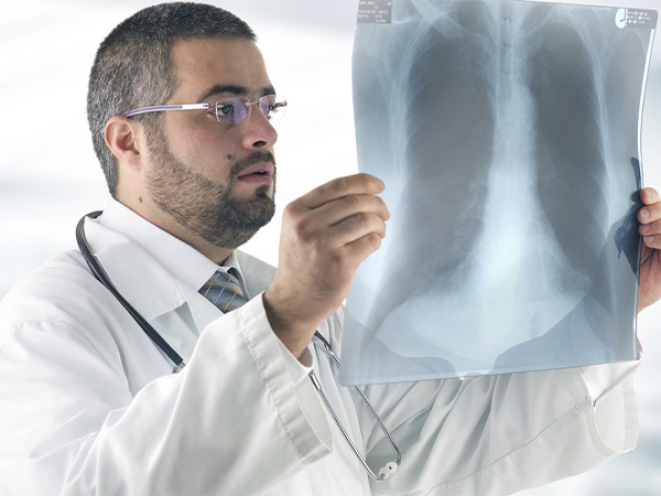 lung cancer