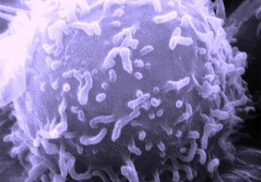 Targeting Adult Acute Lymphoblastic Leukemia