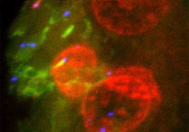 Increasing Liver Cancer Treatment Options