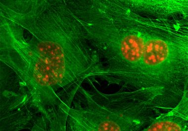 Targeting Breast Cancer