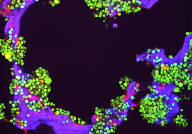 A New Immunotherapy Option for Patients with Multiple Myeloma