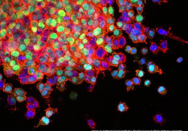 First Targeted Therapeutic for Patients with Lung Cancer Harboring Certain EGFR Mutations 