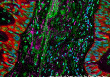 Targeting Non-Small Cell Lung Cancer
