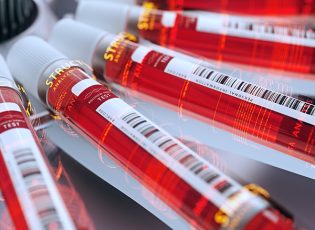 Researching Liquid Biopsy in Cancer Care