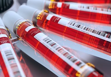 Researching Liquid Biopsy in Cancer Care