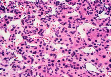 Aiming at Two Protein Targets to Treat Liver Cancer