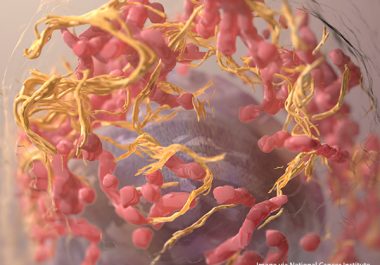 Combining Immunotherapy and Targeted Therapy to Treat Melanoma