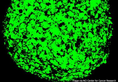 Combining Two Immunotherapeutics for Asbestos-related Cancer