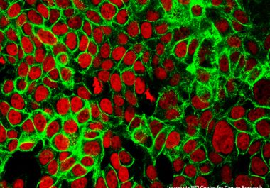 A First-line Immunotherapy for Certain Colon Cancers