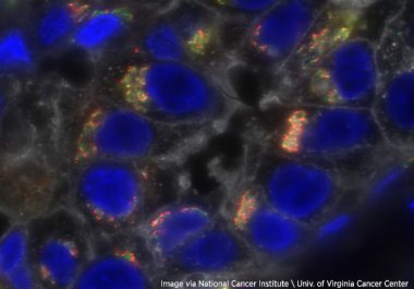 Treating Triple-negative Breast Cancer with Immunotherapy 