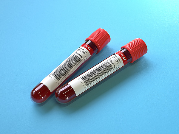 two vials of blood sit on a flat blue surface