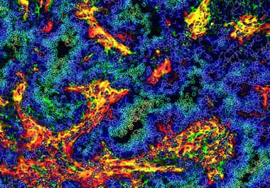 AACR Virtual Special Conference: Tumor Immunology and Immunotherapy