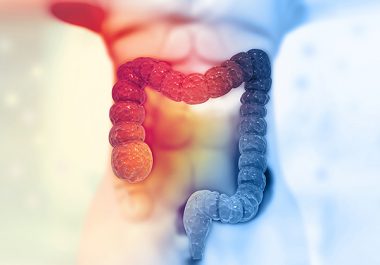 Predicting Colorectal Cancer Recurrence