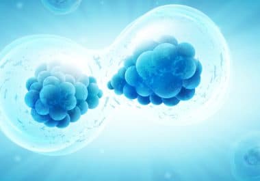 Second DCIS Diagnoses May Not Be Related to Initial Lesion