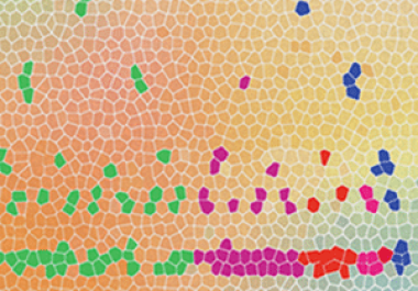 Genetic Mosaicism: How Mutations That Arise in the Embryo May Cause Cancer Later in Life