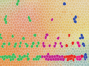 somatic mosaicism