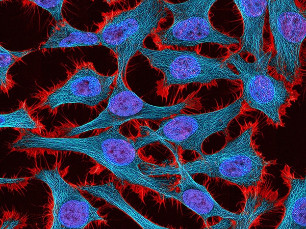 HeLa cells