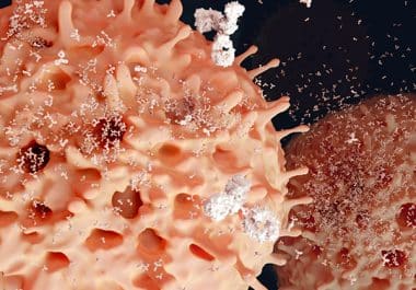 New Combination Therapy for Multiple Myeloma  