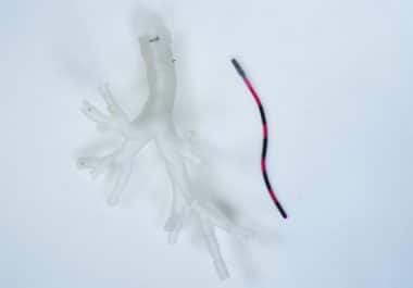 What’s Next: Magnet-Guided Lung Endoscopy