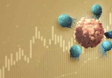 Taking Stock of CAR T-Cell Therapy