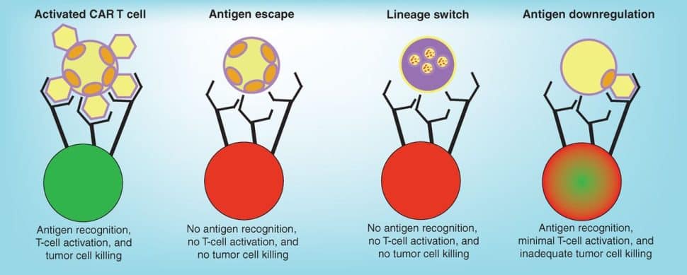 CAR T infographic