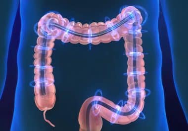 Keep That Colonoscopy Appointment