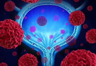 The First Gene Therapy for Bladder Cancer 