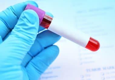 Blood Test Could Predict Cancer Recurrence and Treatment Side Effects