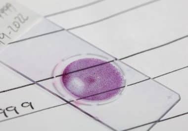 April 21: The Week in Cancer News