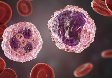 A Cord Blood-based Cell Therapy for Patients With Blood Cancers  
