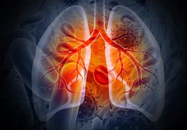 Full Approval for Targeted Therapy for Lung Cancer  