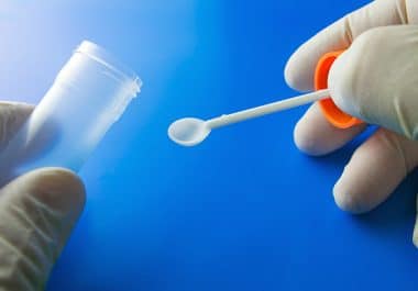 Faulty Samples Frustrate FIT Screening for Colorectal Cancer 