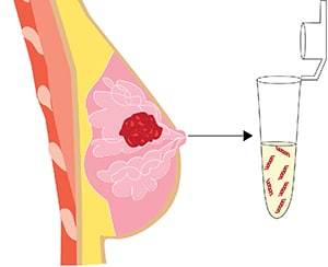 Picture showing how breast milk can contain biomarkers for cancer.