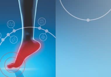 Controlling Peripheral Neuropathy