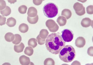 Another BTK Inhibitor for Certain Leukemias and Lymphomas 