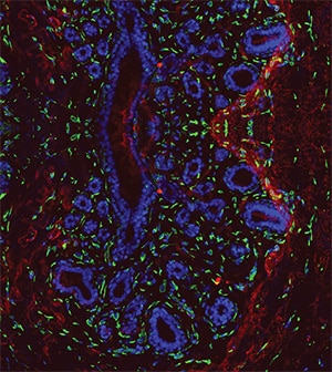 The February cover of AACR Journal Molecular Cancer Research featured an immunofluorescent image of non-BRCA mutant breast tissue, where α6-integrin fluoresces are green, collagen VI fluoresces are red, and DAPI-stained nuclei fluoresce are blue.
