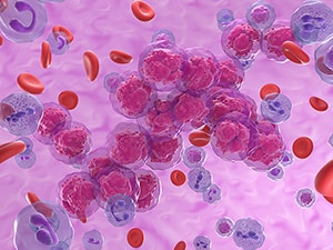 Illustration showing various blood cells in a blood vessel, with a cluster of abnormal lymphocytes centered, which can be an indication of leukemia.