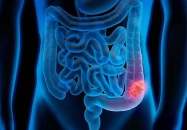 May 31: The Week in Cancer News